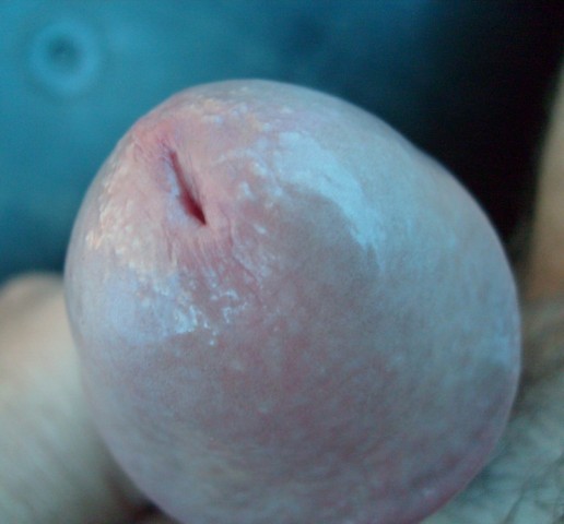 gland 1