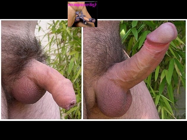 Erection Homme