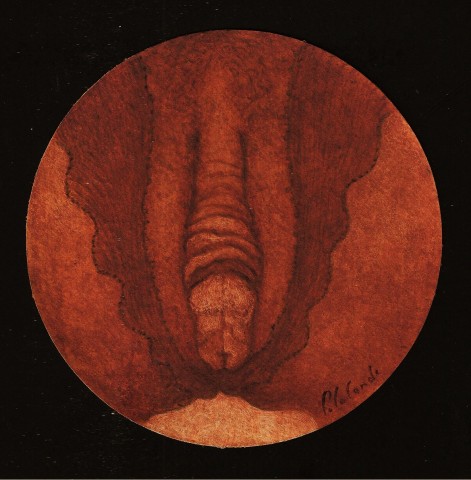 hermaphrodite