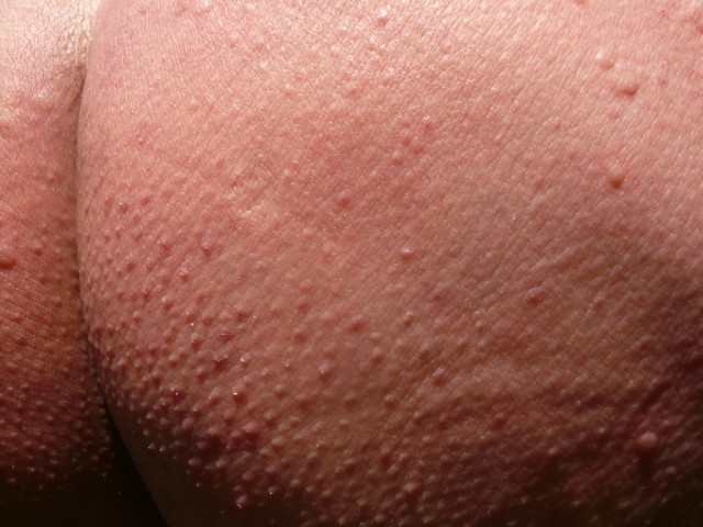P1210458