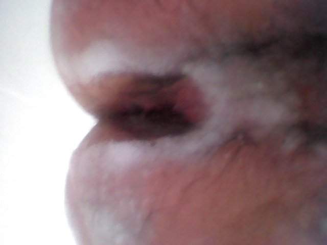 epilation (8)