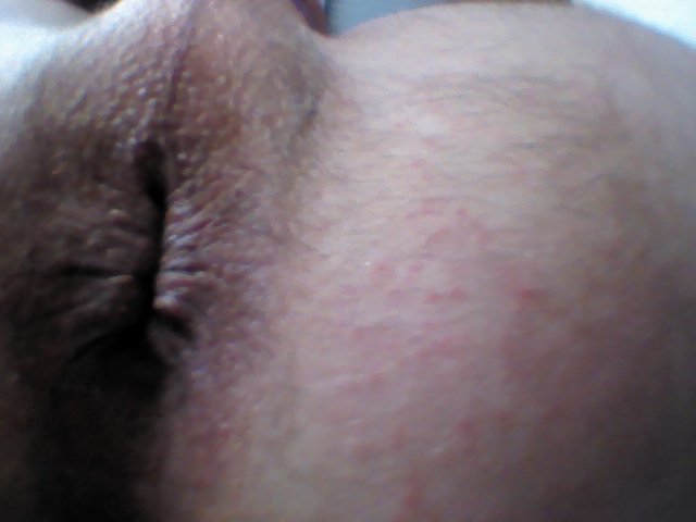 fesse 0431