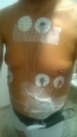 01 - Holter - D - -