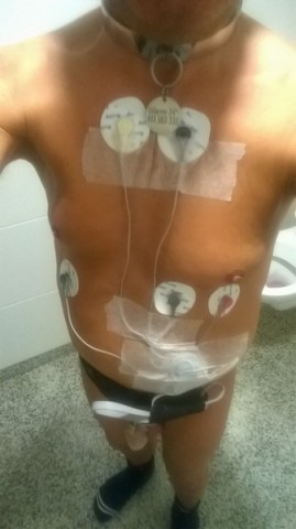 10 - Holter - D - -
