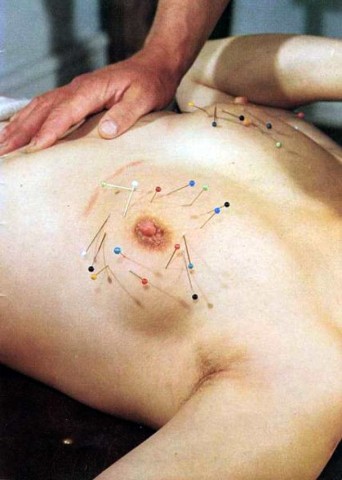Aiguilles dans les seins (116)