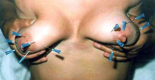 Aiguilles dans les seins (149)