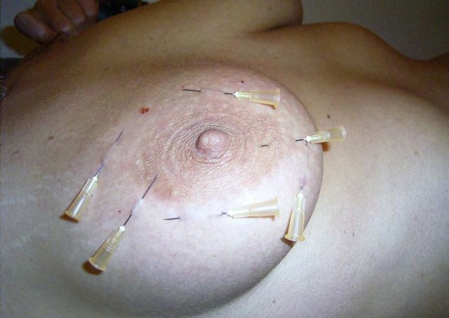 Aiguilles dans les seins (68)