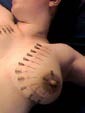 Aiguilles dans les seins2 (118)