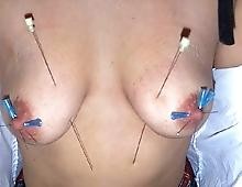 Aiguilles dans les seins1 (1)
