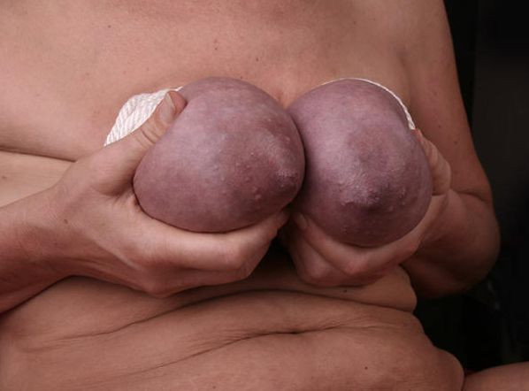 Travail des seins5 (206)