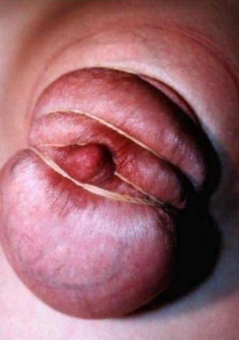 Travail des seins5 (244)