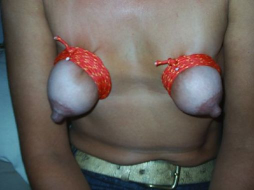 Travail des seins6 (142)