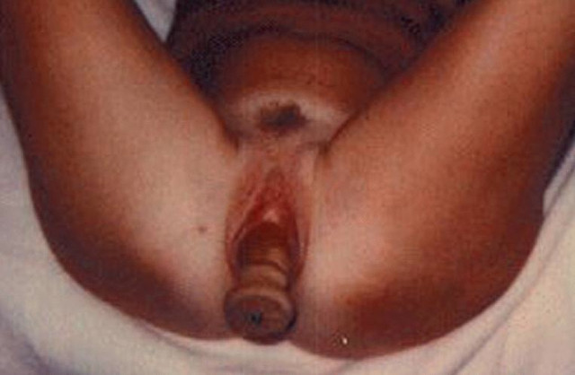 Travail des seins6 (153)