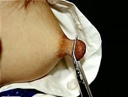 Travail des seins7 (75)