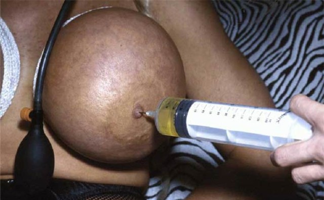 Travail des seins8 (85)