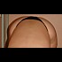 fesses