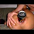 dilatation