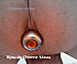 bijou anal