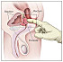 Prostate.jpg