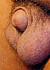 micropenis.jpg