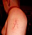 scarification 001