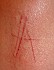 scarification 004