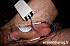 e-stim